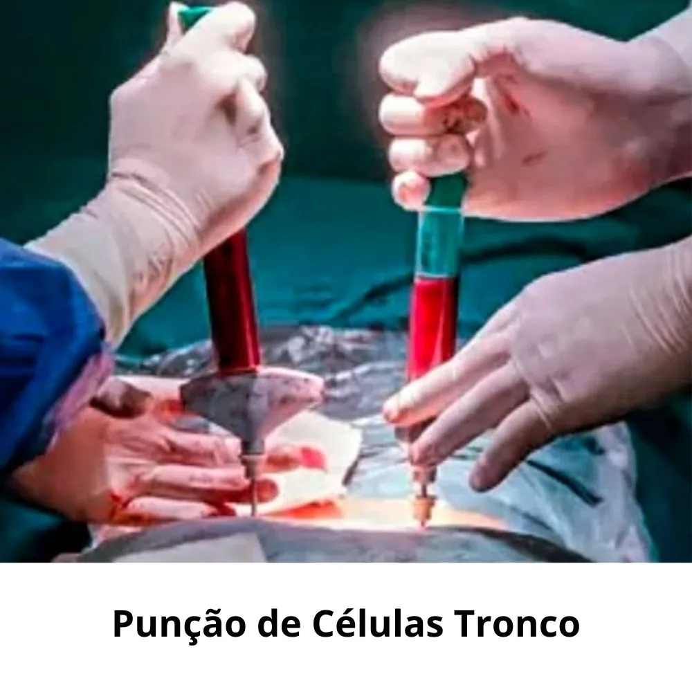 Punção de células tronco
