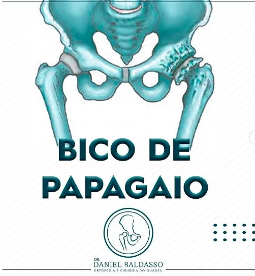 Bico de papagaio no quadril
