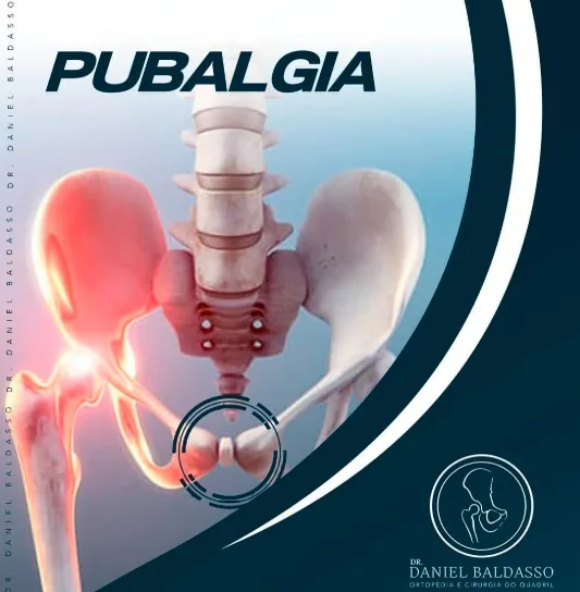 Pubalgia